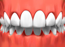 Porcelain Veneers Whitby3